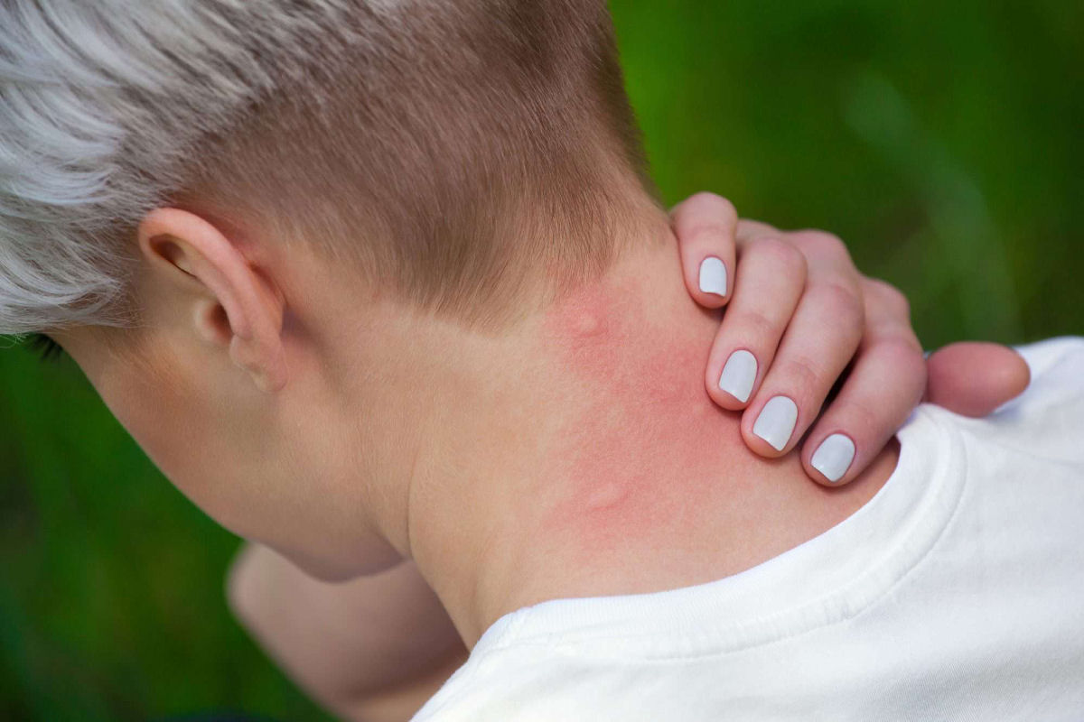 Por que os mosquitos picam algumas pessoas mais do que outras?