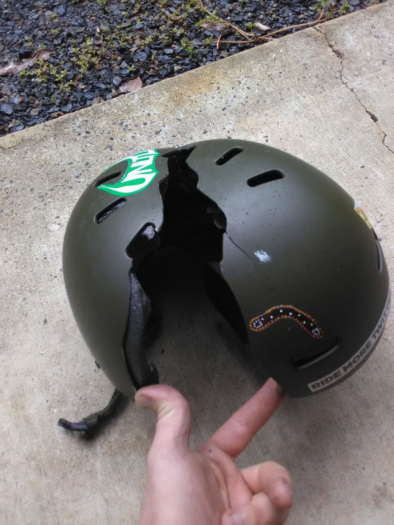 Fotos brutais que vão lembrá-lo de sempre usar um capacete 48