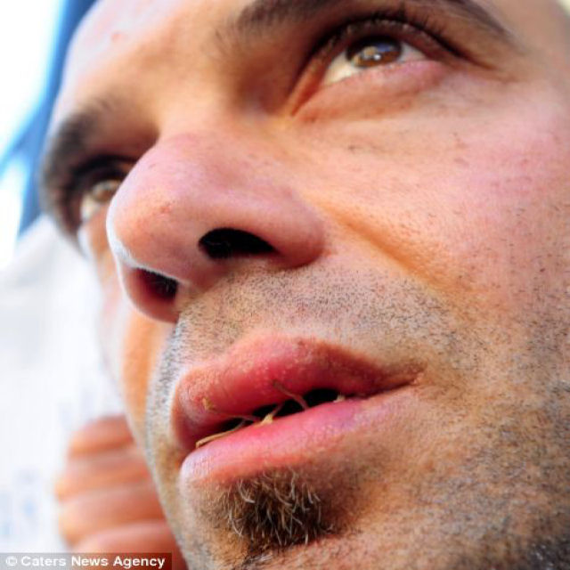 Taxista costura a boca em greve de fome depois de ser despedido