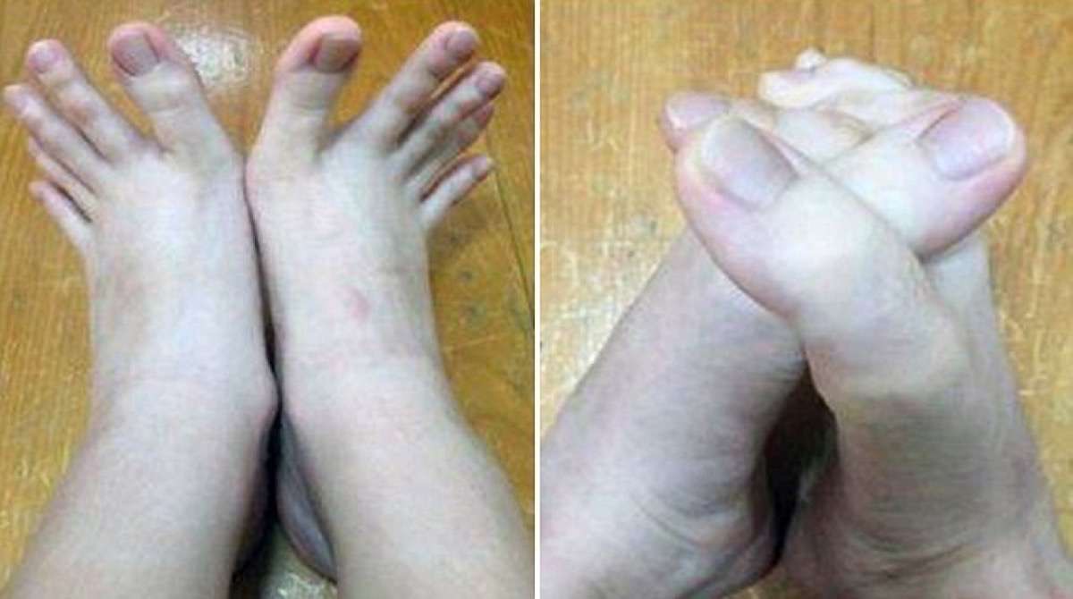 Mulher confunde a internet depois de postar fotos de seus dedos bizarros