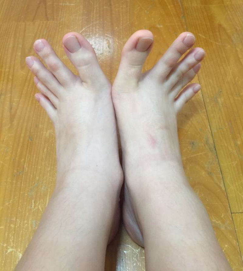 Mulher confunde a internet depois de postar fotos de seus dedos bizarros