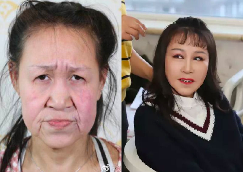 Adolescente chinesa de 15 anos, com aparncia de 60, passou por cirurgia para ficar mais jovem