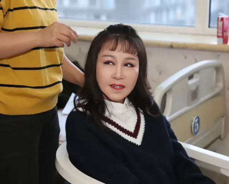 Adolescente chinesa de 15 anos, com aparncia de 60, passou por cirurgia para ficar mais jovem