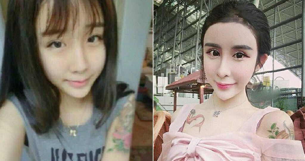 Uma adolescente chinesa recorre à cirurgia estética extrema por amor 01