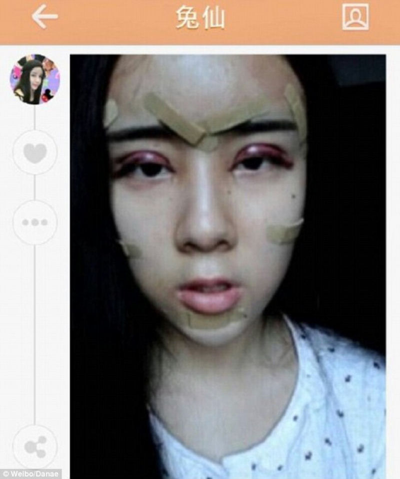 Uma adolescente chinesa recorre à cirurgia estética extrema por amor 03