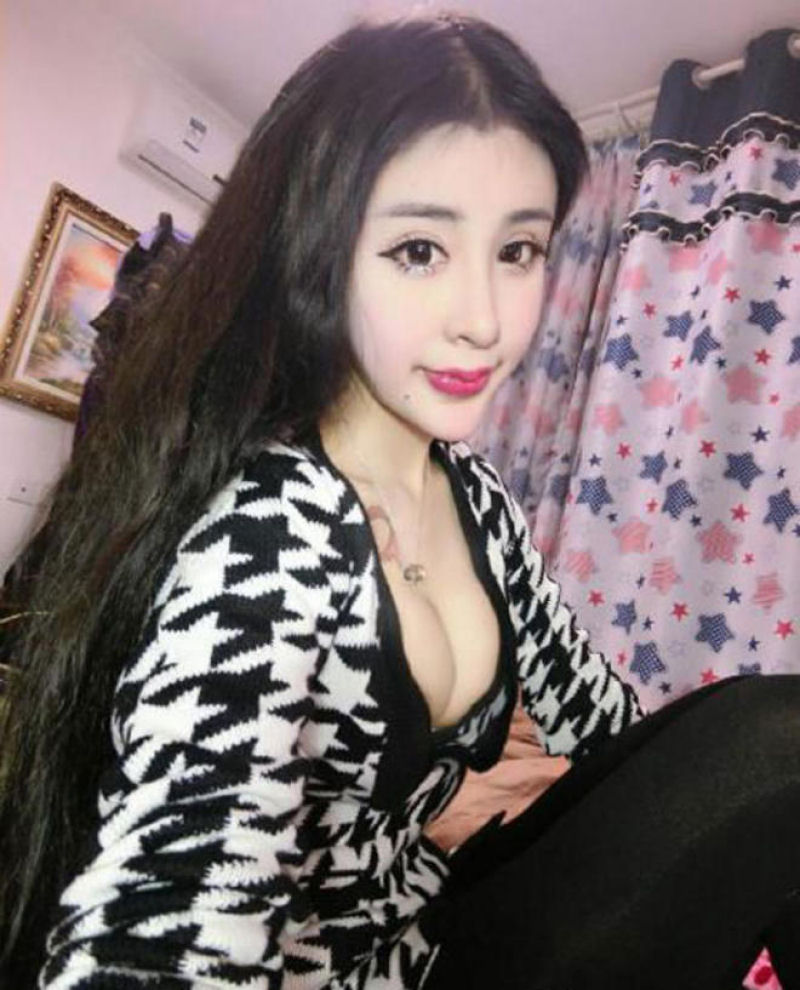 Uma adolescente chinesa recorre à cirurgia estética extrema por amor 10