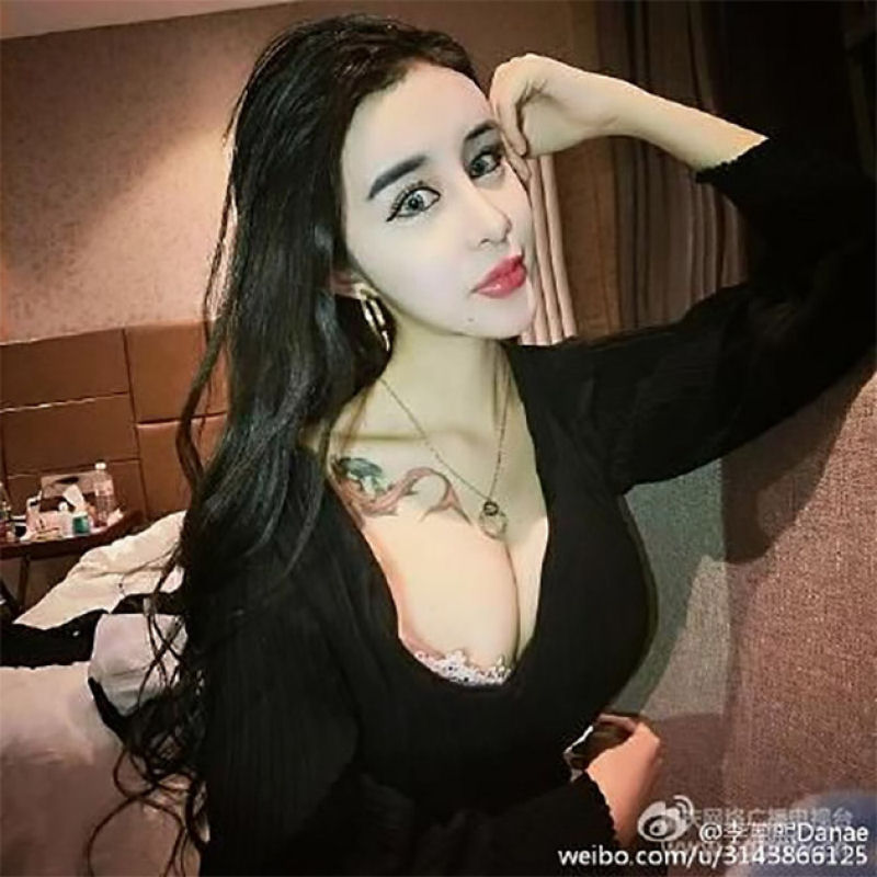 Uma adolescente chinesa recorre à cirurgia estética extrema por amor 13
