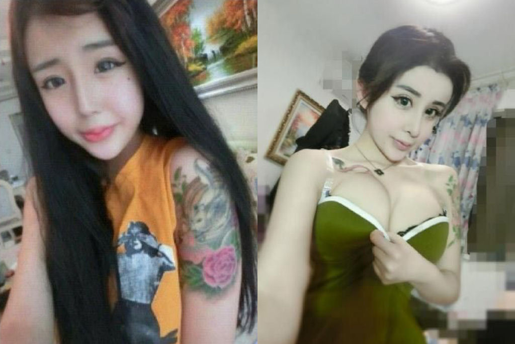 Uma adolescente chinesa recorre à cirurgia estética extrema por amor 16
