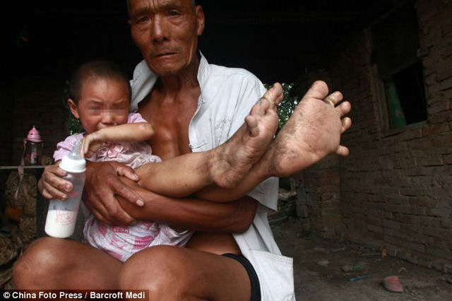 Garota chinesa com pés gigantes 03