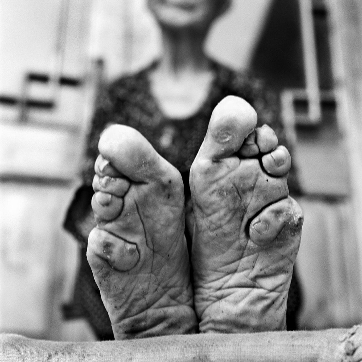 História viva: fotos de mulheres com os pés atados 01