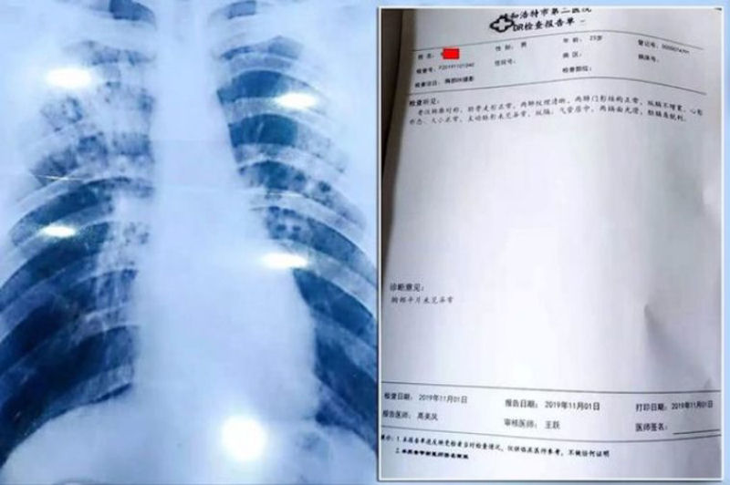 Professor mongol comprou diagnstico falso de tuberculose on-line para que pudesse tirar frias mais longas