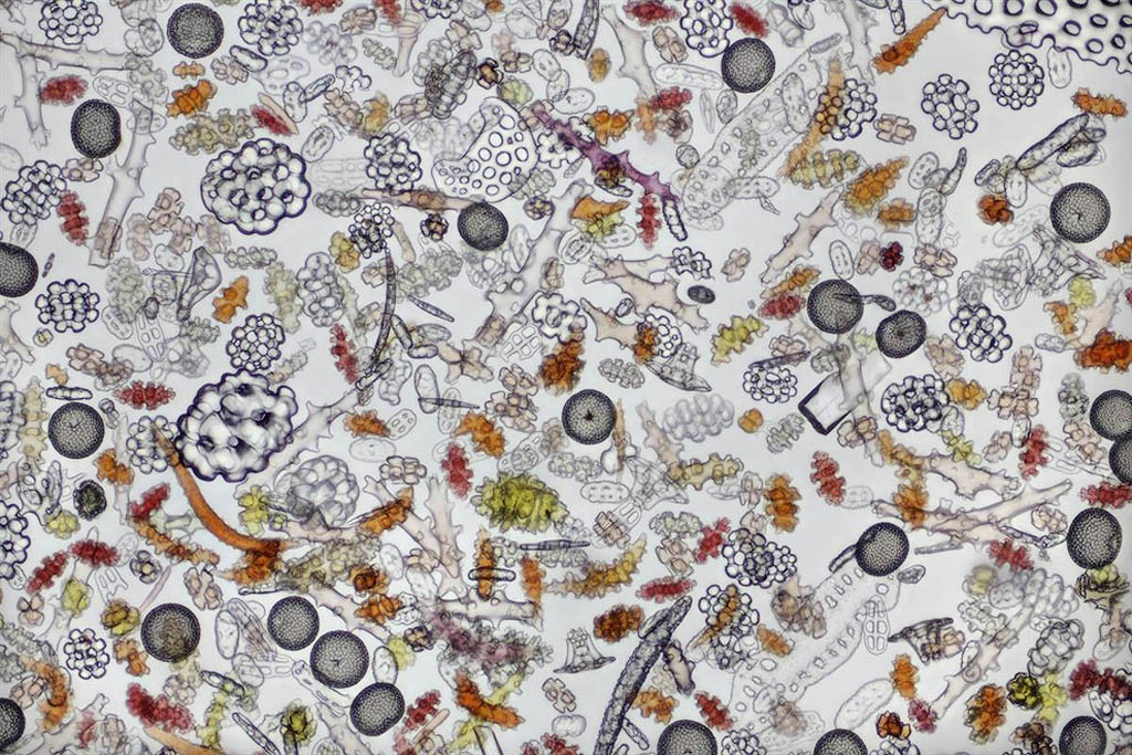 Micrografias assustadoras do Small World 2012