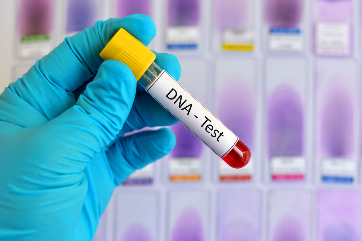 Teste DNA revela que seu pai no  seu pai biolgico, seno o mdico de fertilidade de seus pais