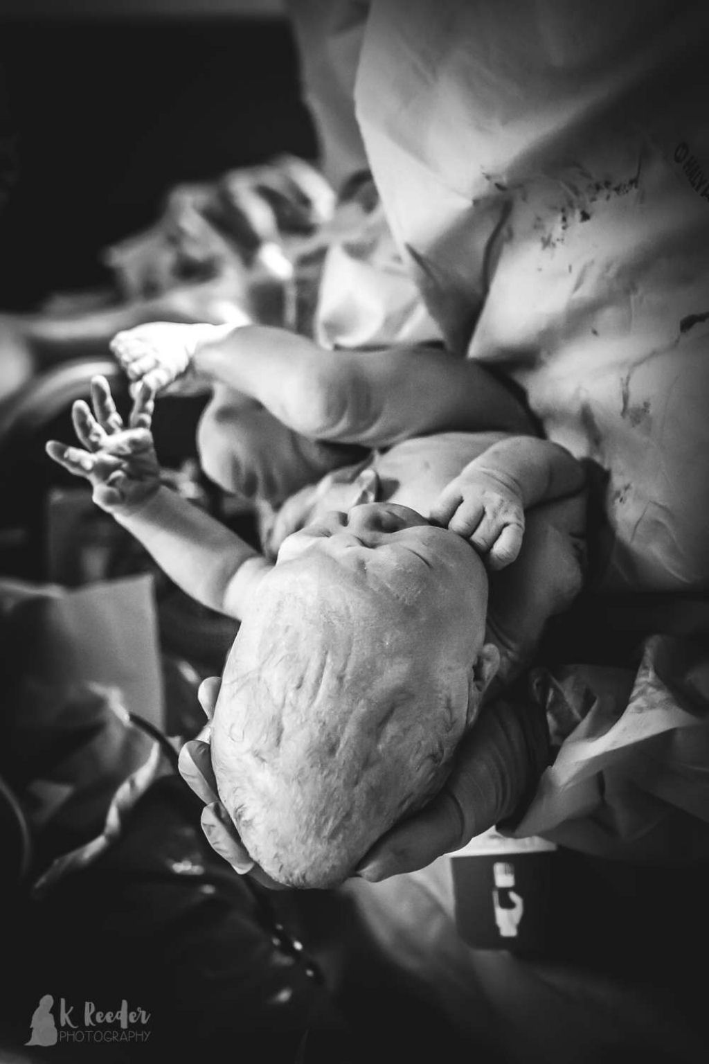 Imagens incrveis revelam o que pode acontecer com a cabea de um beb durante o parto