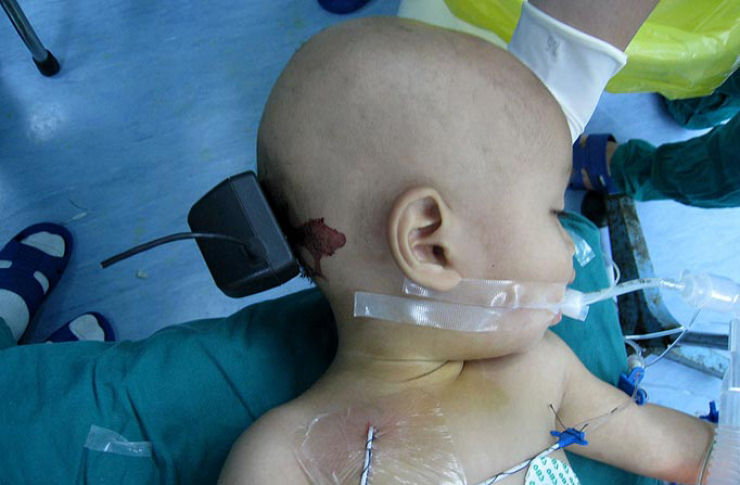 Garoto de 1 ano cravou um carregador de celular na cabea