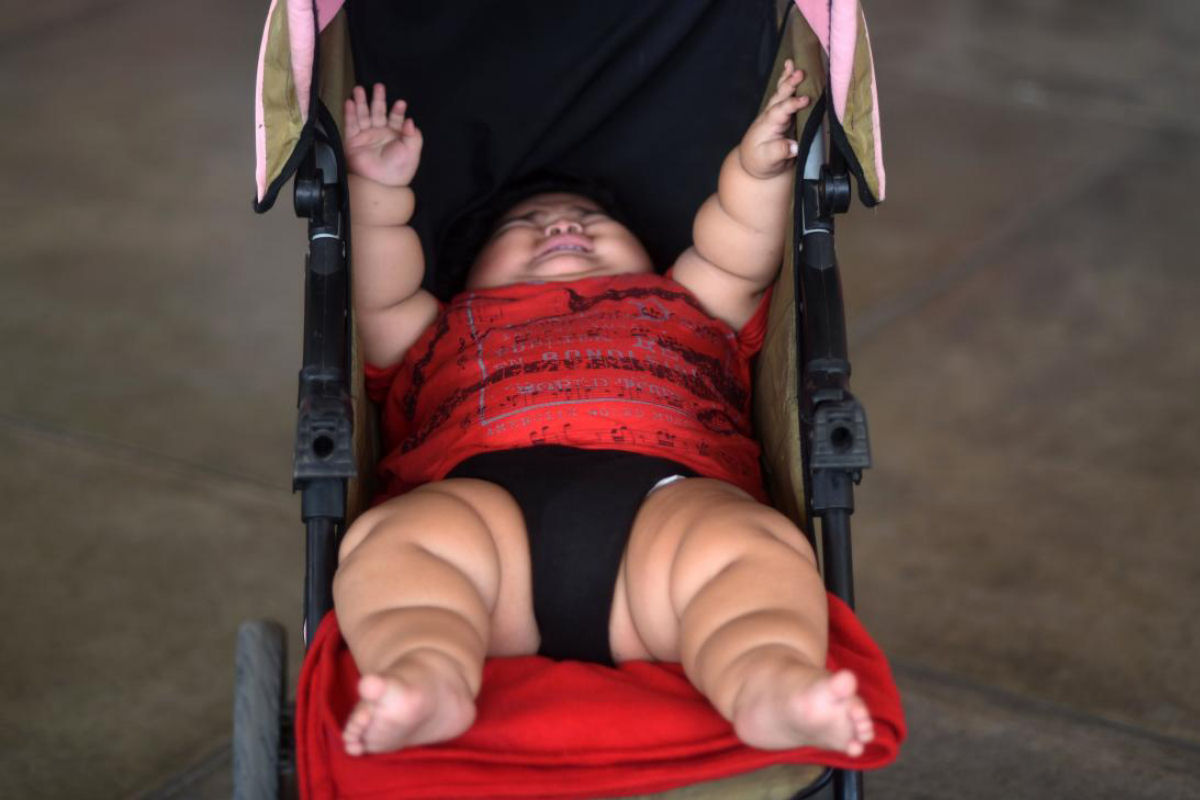O drama de Luisinho, o beb de 10 meses que pesa 30 quilos 01