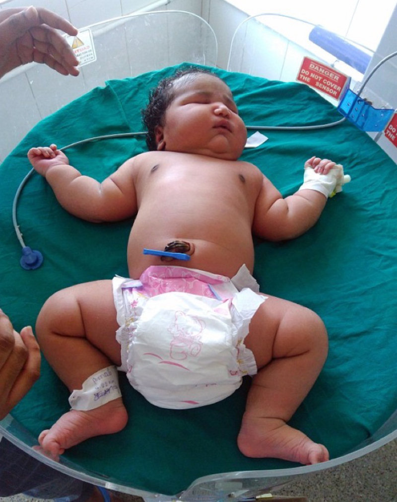 Nasce uma beb de 7 quilos, a maior do mundo