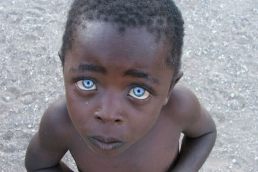 A cor dos olhos deste garoto surpreendeu o mundo