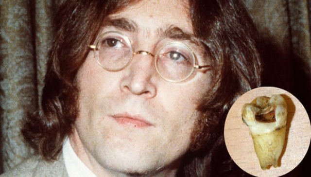 Pagam mais de 30.000 dlares por um dente cariado de John Lennon