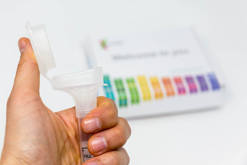 Homem surpreendeu a namorada com um kit de teste de DNA... deu ruim