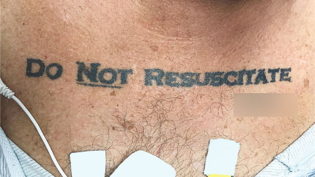 Mdicos ficam confusos com paciente inconsciente tatuado com <u>No</u> Ressuscitar