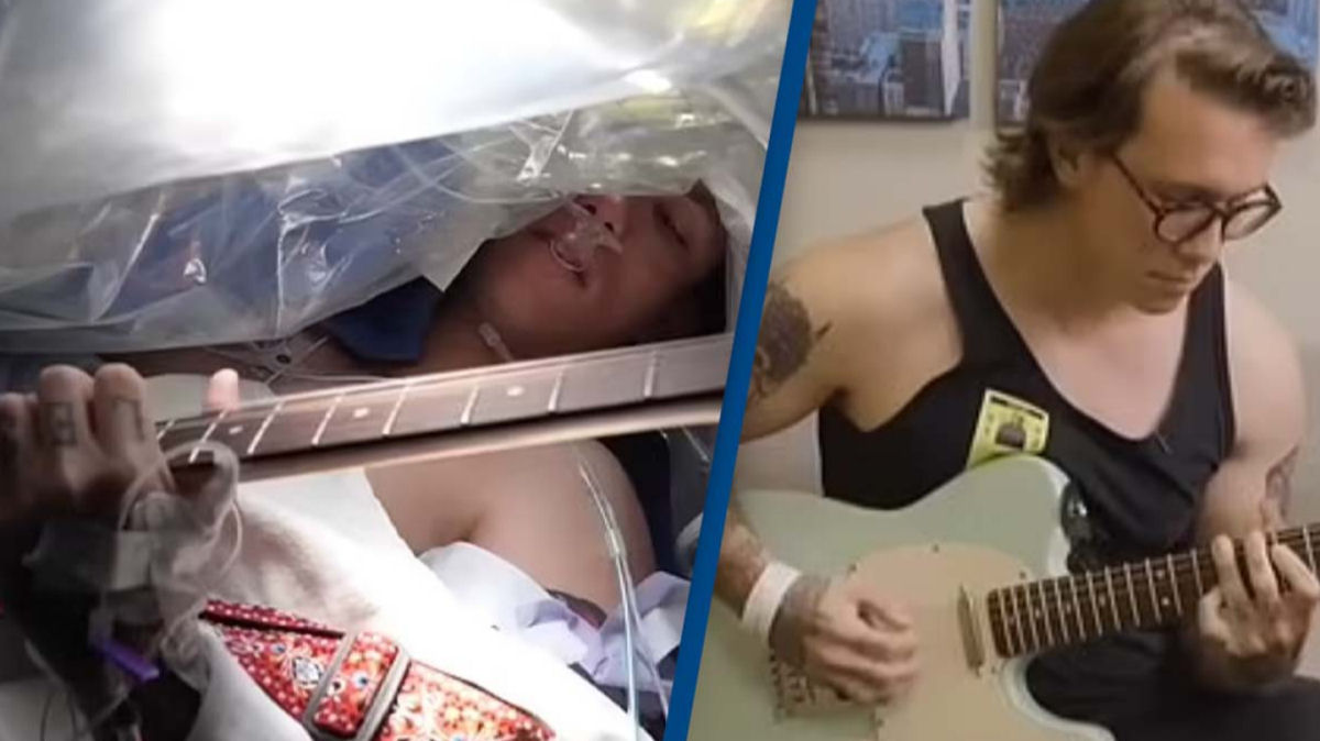 Paciente fica acordado e toca guitarra durante a cirurgia enquanto os mdicos removem um tumor de seu crebro