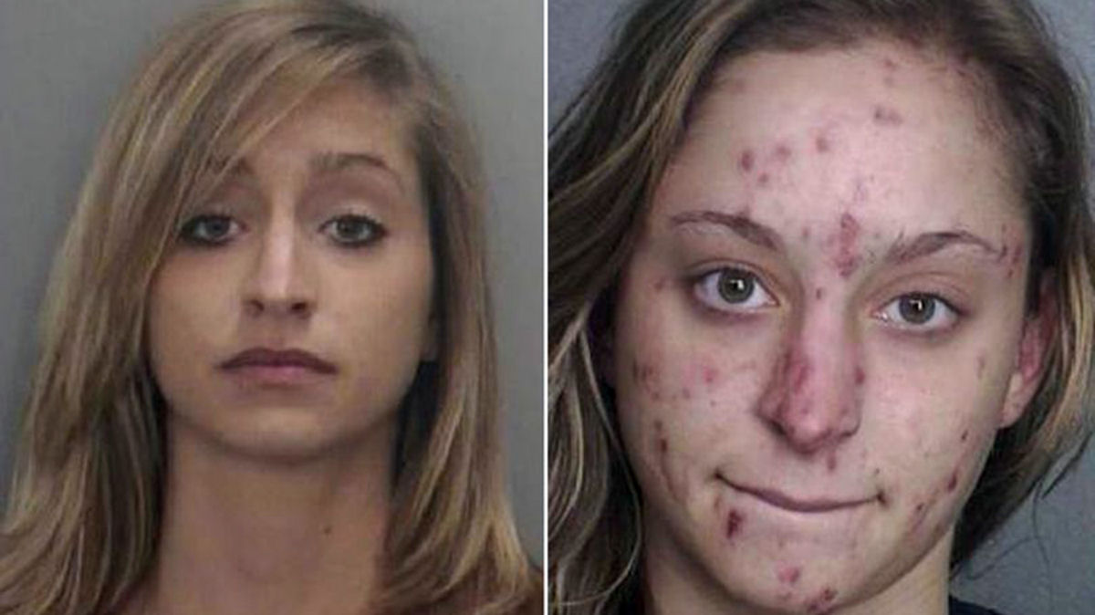 As desagradveis e terrveis fotos de pessoas antes e depois que as drogas entraram em suas vidas