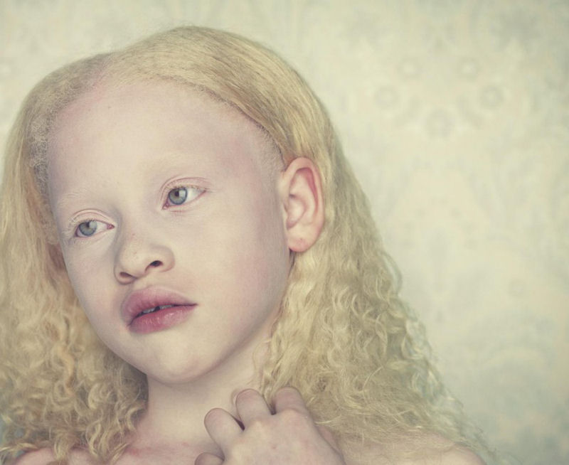 Albinos, um belo trabalho de fotografia 01
