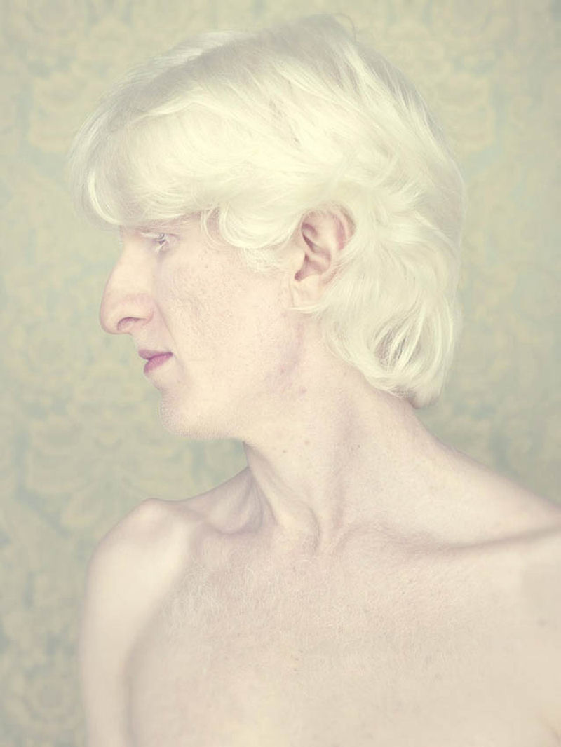Albinos, um belo trabalho de fotografia 04