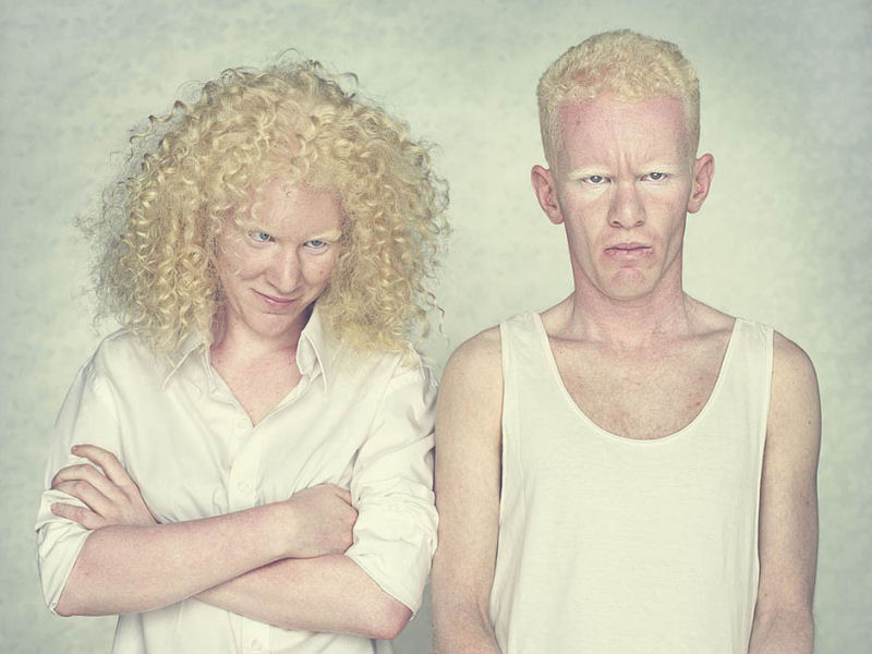 Albinos, um belo trabalho de fotografia 13