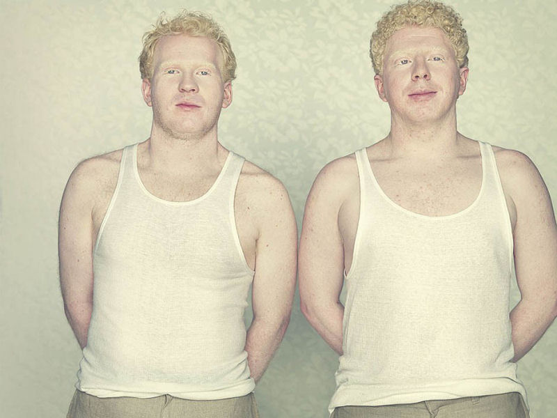 Albinos, um belo trabalho de fotografia 17
