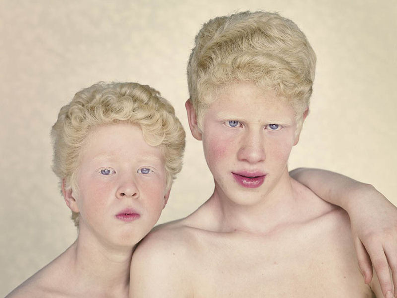 Albinos, um belo trabalho de fotografia 18