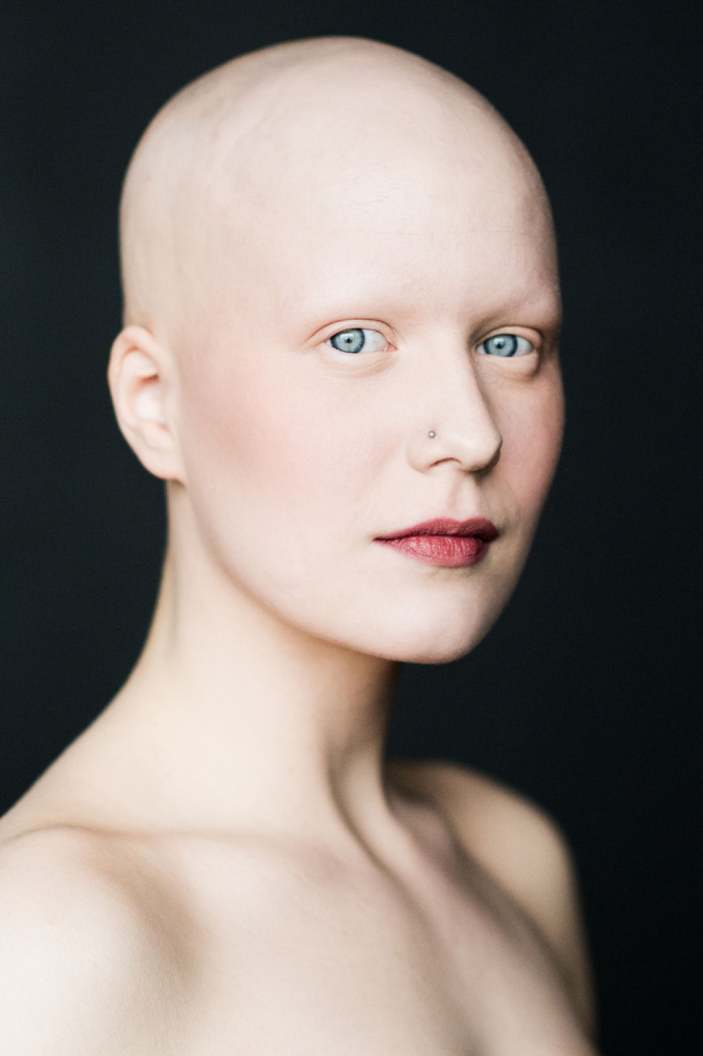 7 retratos impressionantes de mulheres com alopecia redefinem a feminilidade 01