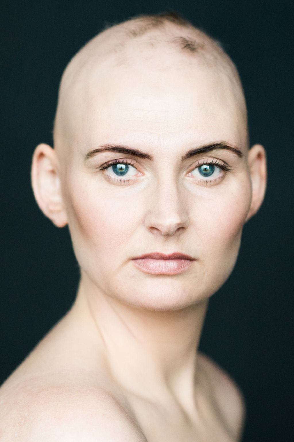 7 retratos impressionantes de mulheres com alopecia redefinem a feminilidade 02