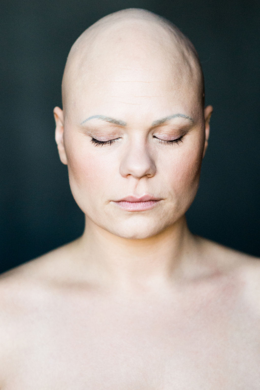 7 retratos impressionantes de mulheres com alopecia redefinem a feminilidade 03