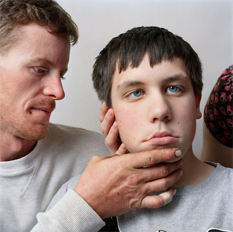 About Face: Colocando uma cara na paralisia 14