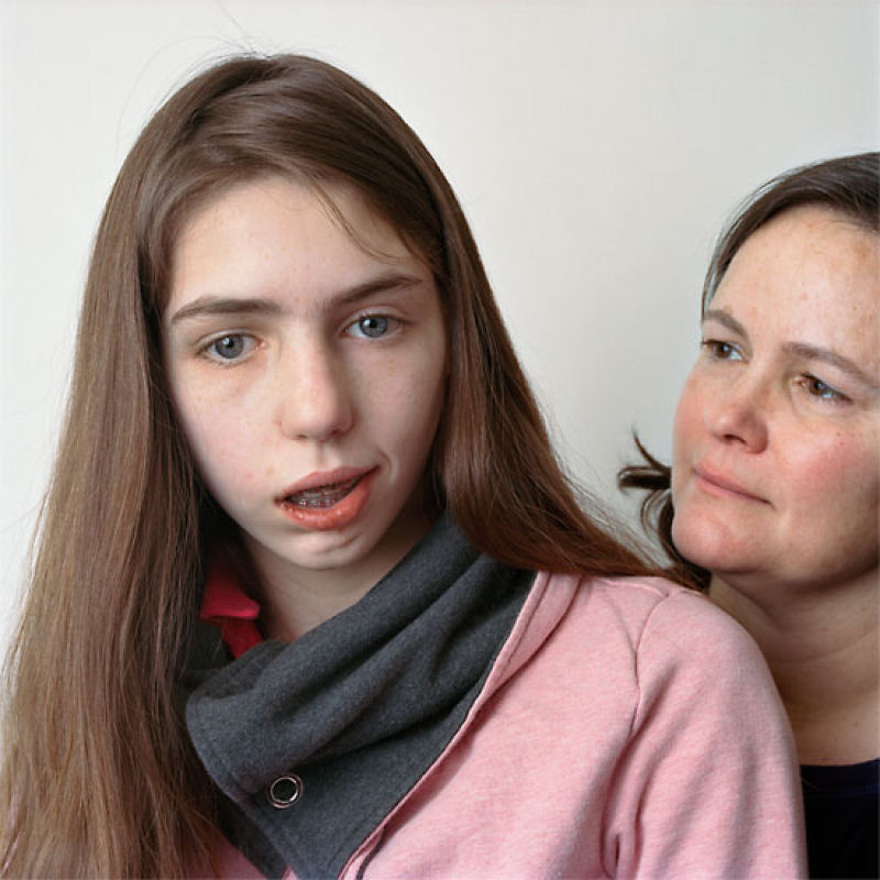 About Face: Colocando uma cara na paralisia 20