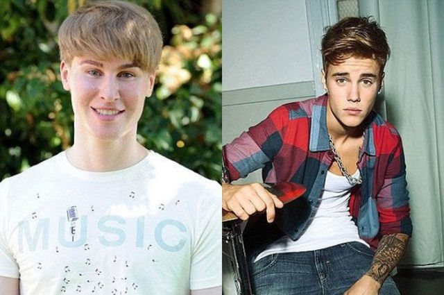 Homem investe 100 mil dólares e 5 anos de cirurgias plásticas para parecer-se com Justin Bieber 05