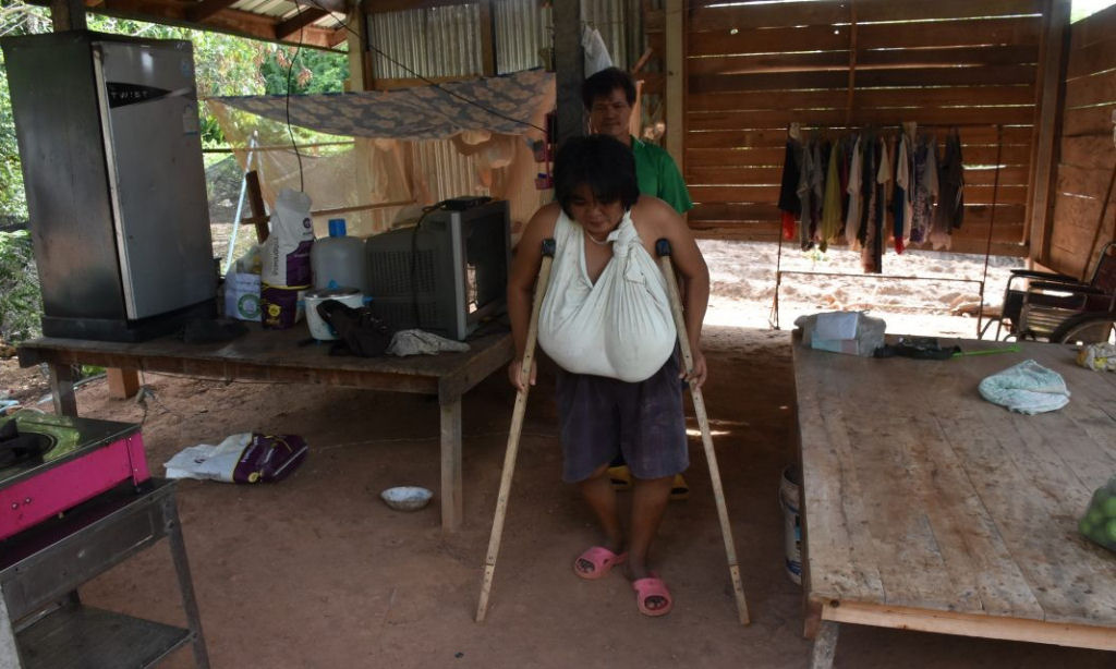 Misteriosa condio faz com que os seios de uma tailandesa cresam incontrolavelmente