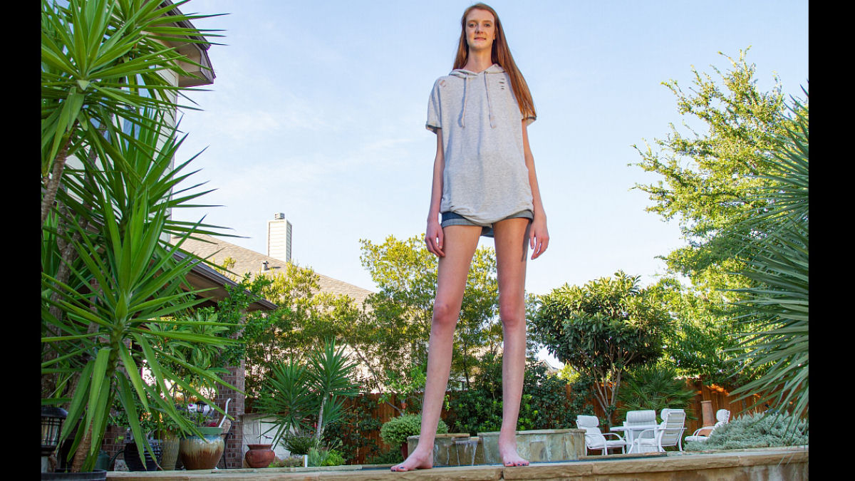 Garota de 17 anos tem as pernas mais longas do mundo