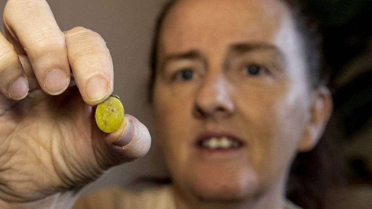 Mulher sofreu dores em seu nariz durante 37 anos e um teste de coronavirus revelou a verdadeira razão