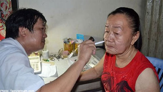 Jovem vietnamita envelhece da noite para o dia