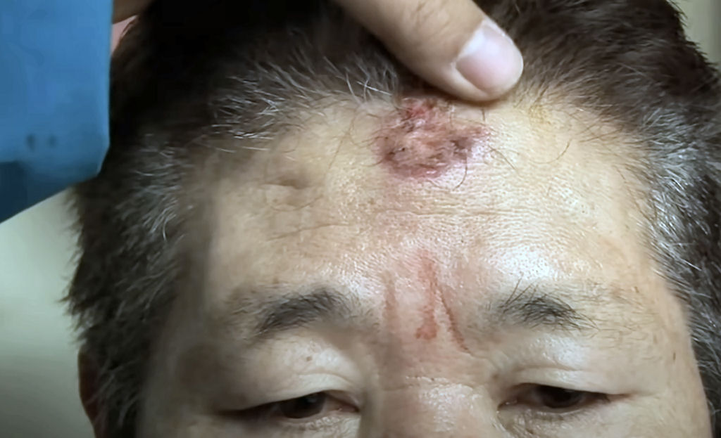 Sul-coreano treina batendo a cabeça contra uma árvore todos os dias há cinco anos