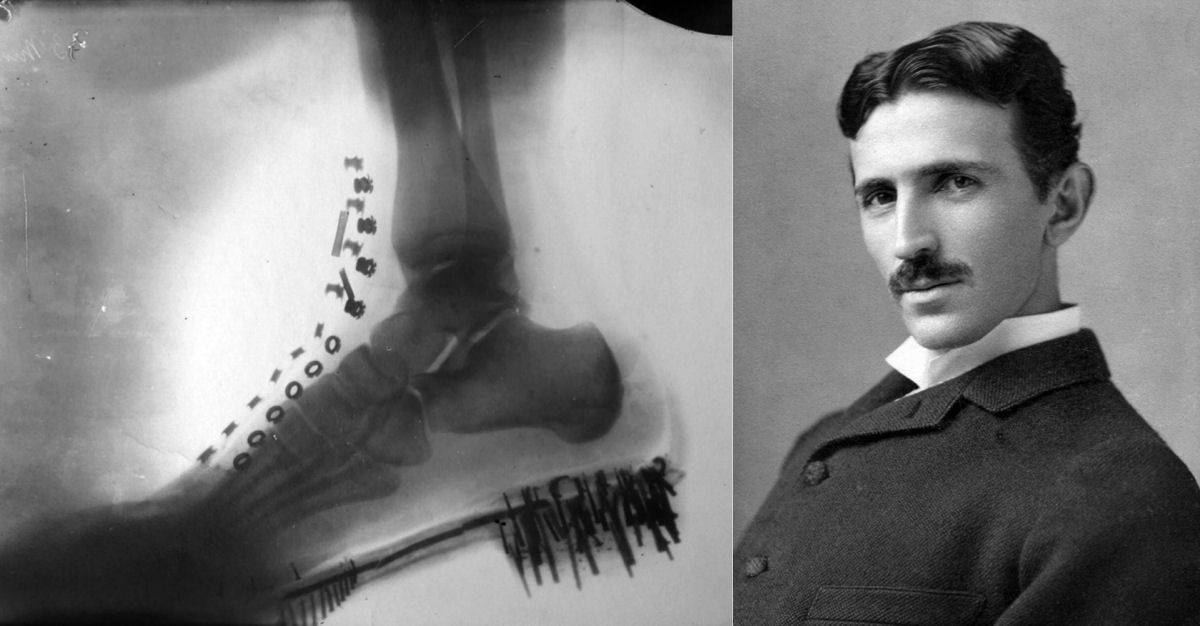 Nikola Tesla fez um raio-X de seu prprio p com uma mquina que ele inventou em 1896