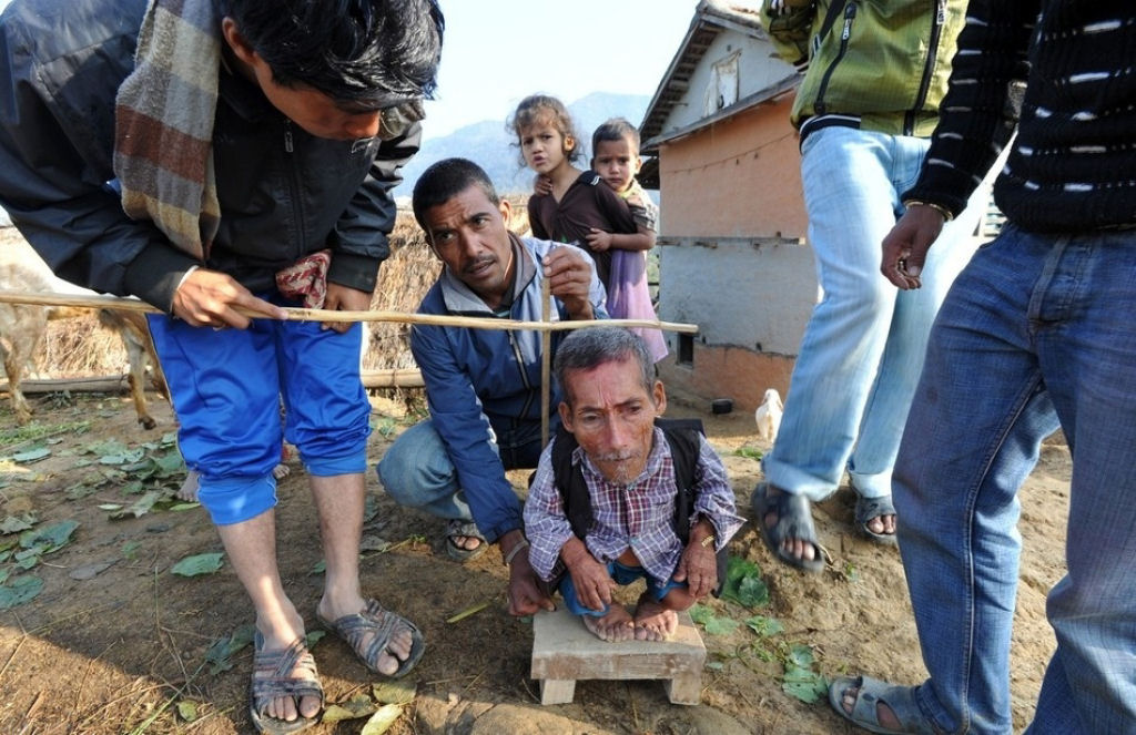 Novo menor homem do mundo encontrado em aldeia do Nepal 03