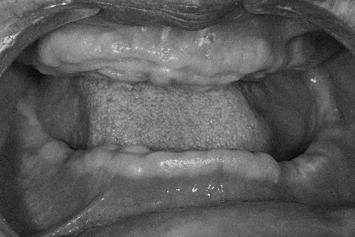 A pavorosa histria do psiquiatra que tentou 'curar' seus pacientes arrancando seus dentes