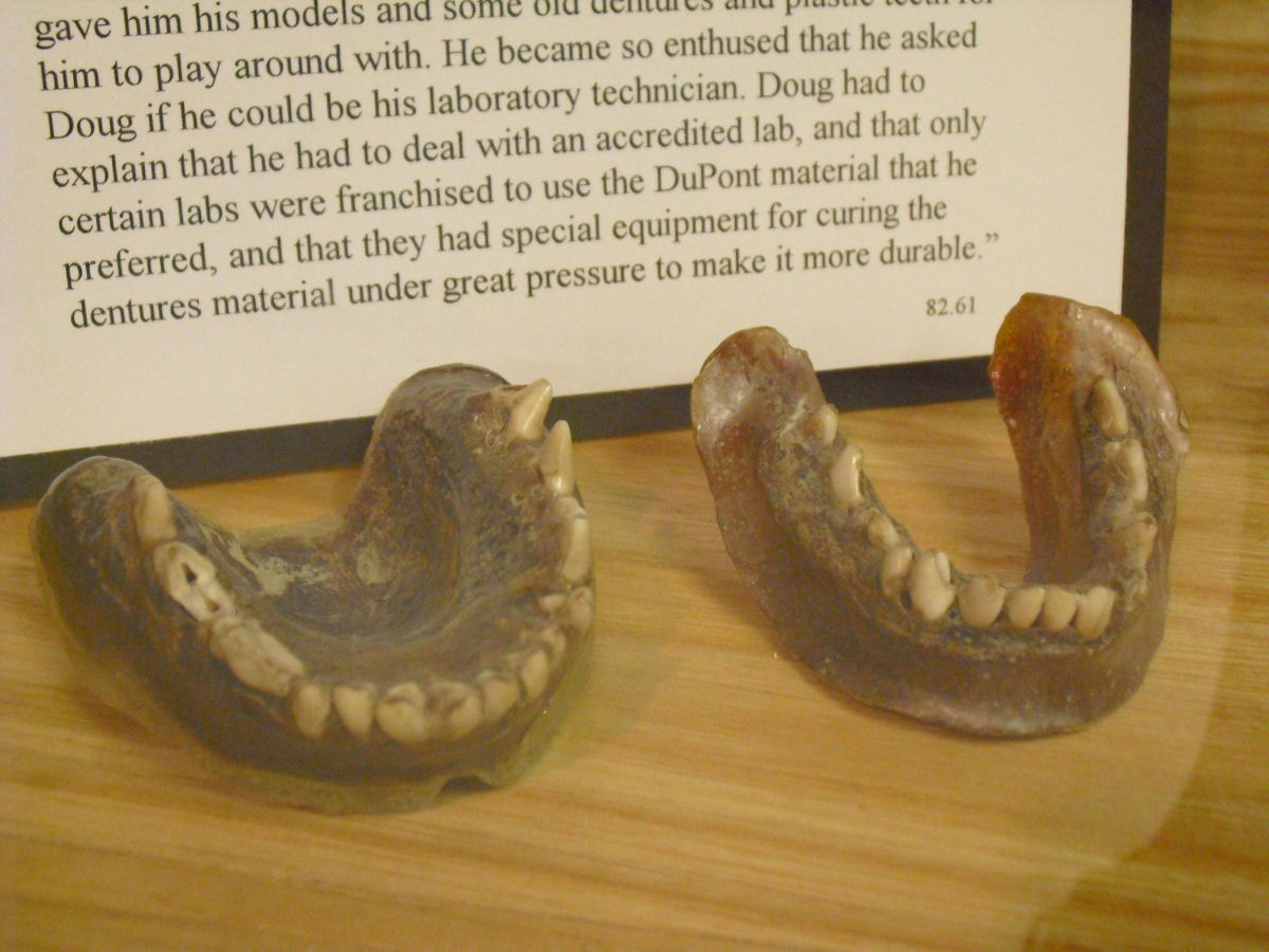 Nos anos 1900, um garimpeiro banguela sem remédio fez uma dentadura com dentes de coiote
