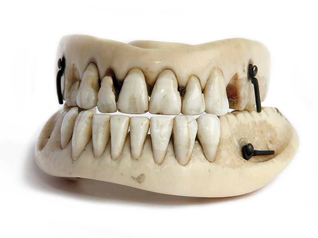 Muitas das dentaduras dos séculos 18 e 19 foram feitas com os dentes dos soldados mortos em Waterloo 01