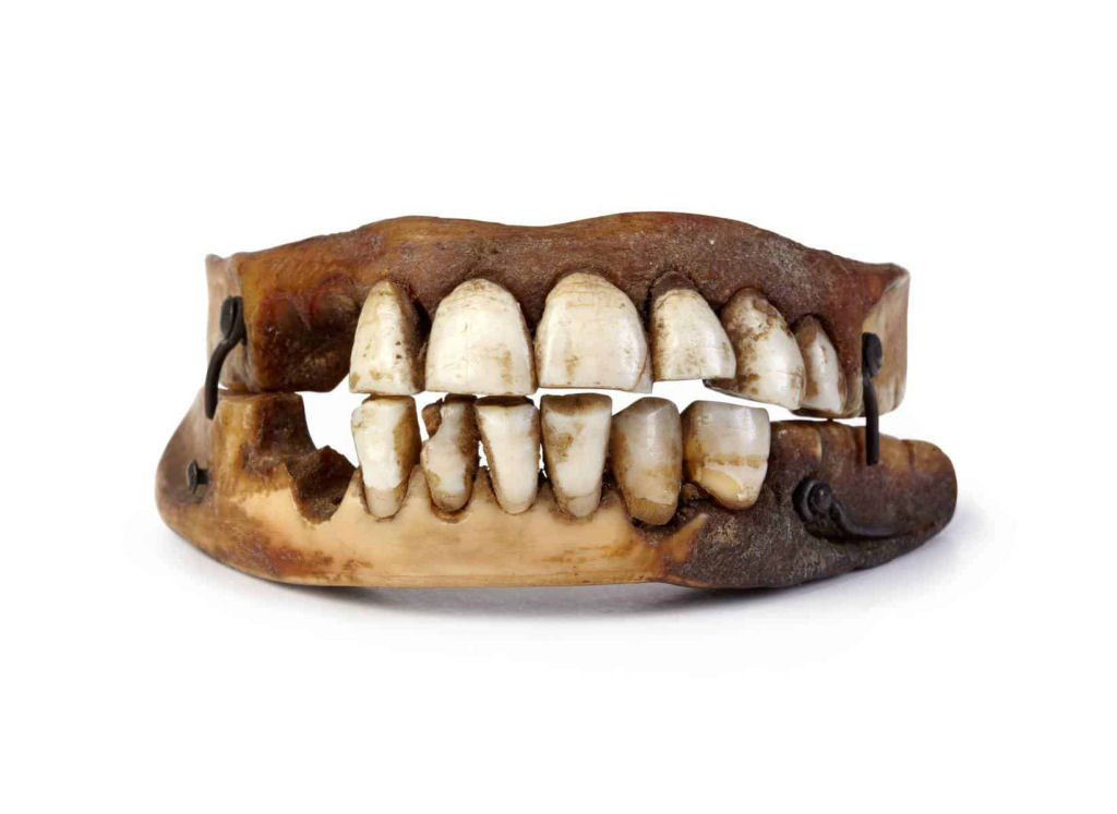 Muitas das dentaduras dos séculos 18 e 19 foram feitas com os dentes dos soldados mortos em Waterloo 02