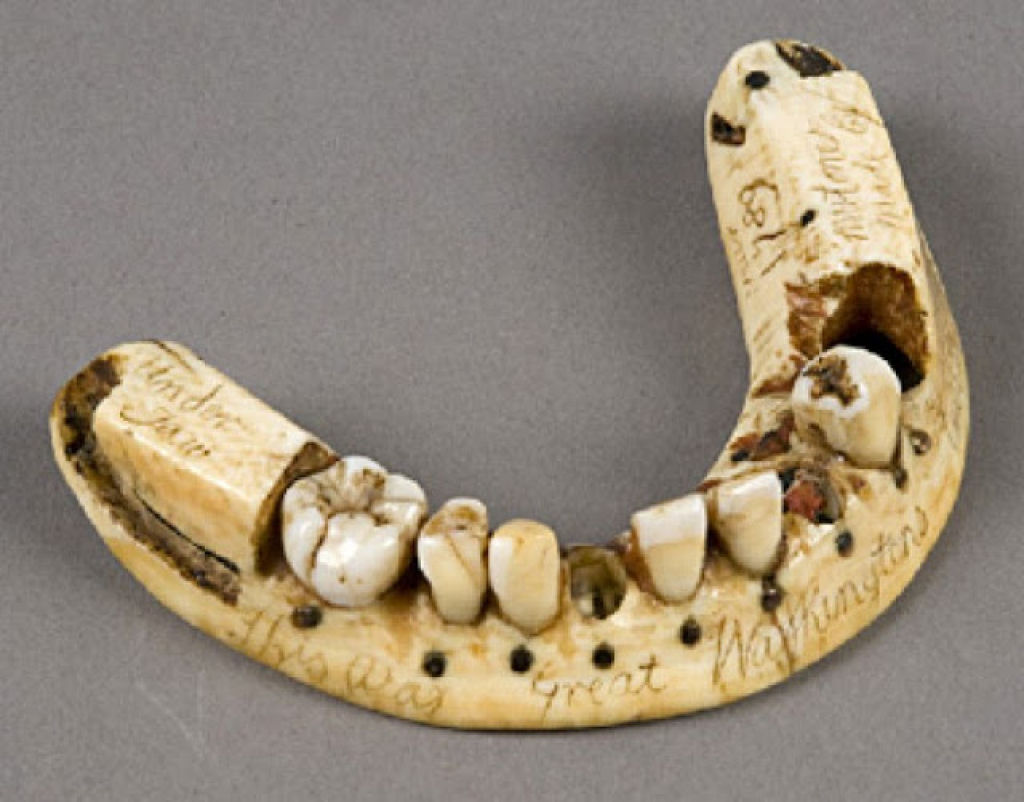 Muitas das dentaduras dos séculos 18 e 19 foram feitas com os dentes dos soldados mortos em Waterloo 06